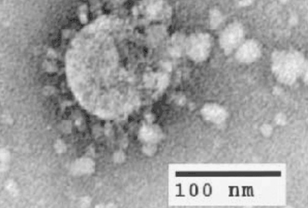 Дыхание смерти: что породило самые страшные и смертельно опасные коронавирусы